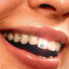 Cesta k zářivému úsměvu: dentální šperky