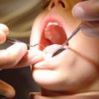 Keramické korunky a můstky