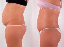 exilis-spojeno