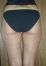 UltraShape