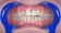 American Dental Dentální hygiena