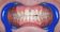 American Dental Dentální hygiena