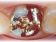 Dentální centrum - MUDr. Rafael Chajrušev Cerec (zákroky pomocí robotu)