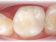 Dentální centrum - MUDr. Rafael Chajrušev Cerec (zákroky pomocí robotu)