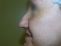 Operace nosu (Rhinoplastika)