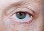 Operace očních víček (Blepharoplastika)