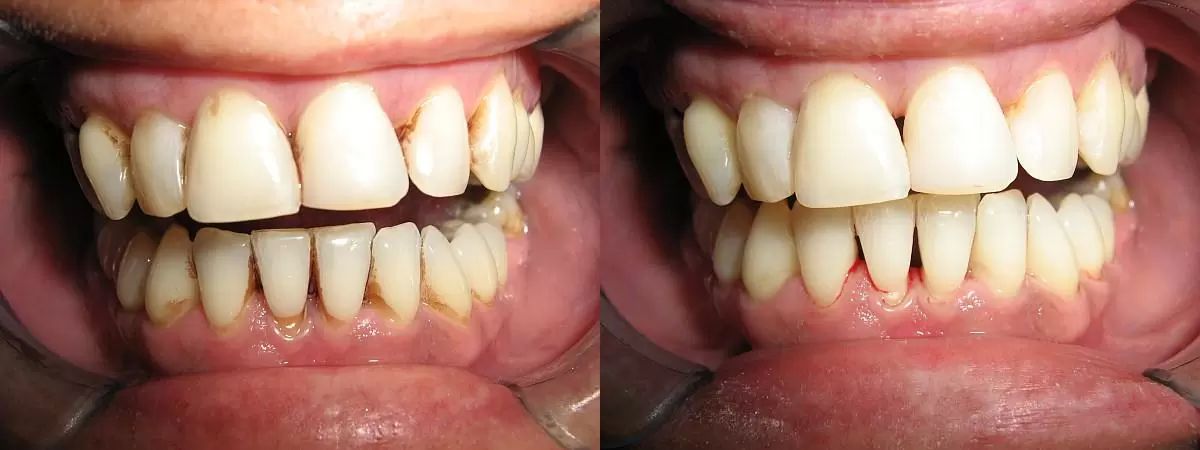 dentalni hygiena 2