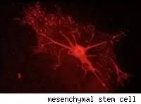 mesenchymal stem cell