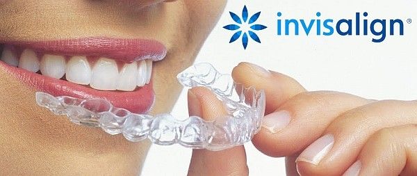 invisalign5