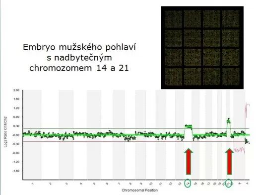 Embryo muzskeho pohlavi nadbytecny chromozom 14 21