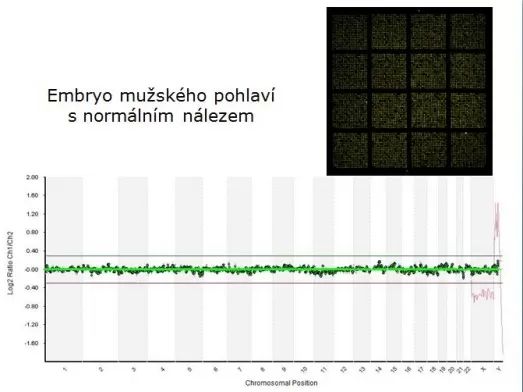 Embryo muzskeho pohlavi normalni nalez