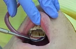 dentalni hygiena 1a