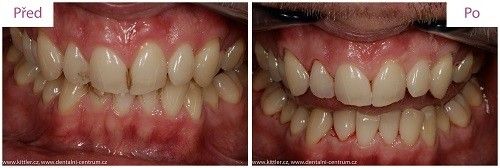 kittler dentalni hygiena 2