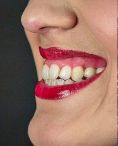 MUDr. Alexander Schill - Vizualizace Vašeho nového úsměvu - abychom Vám mohli změnu Vašeho úsměvu dopředu ukázat, máme na klinice malé fotostudio, kde Vás vyfotíme, a do několika minut Vám pomocí speciálního počítačového programu navrhneme nový úsměv.