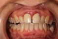 AES clinic - stomatologie & zubní hygiena - fotka před - AES clinic - stomatologie & zubní hygiena