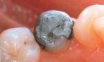 Keramické korunky a můstky - fotka před - M-DENT - Privátní zubní ordinace doktora Majera