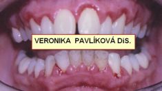 Dentální hygienistka Veronika Pavlíková DiS. - fotka před - Dentální hygienistka Veronika Pavlíková DiS.