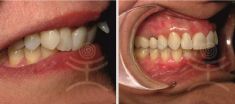 Ortodoncie - fotka před - Mediestetik, skupina klinik - STOMATOLOGIE