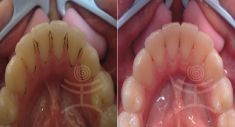 Mediestetik, skupina klinik - STOMATOLOGIE - fotka před - Mediestetik, skupina klinik - STOMATOLOGIE