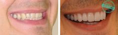 Ortodoncie - fotka před - Brandeis Clinic by Radoslav Lacina