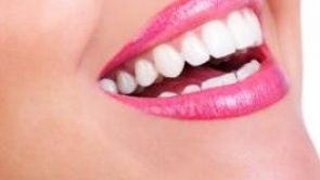 Bílý zub = zdravý zub! Moderní metody bělení zubů