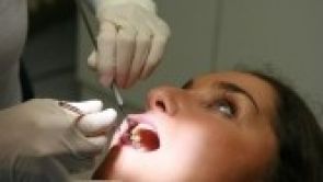 Dentální hygiena z rukou profesionálů