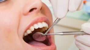Nové trendy ve stomatologii