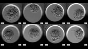 Monitoring embryií pomocí přístroje EnbryoScope®