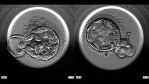 Monitoring vývoje embryií přístrojem EnbryoScope®