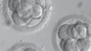 Transfer jediného embrya – méně je někdy více