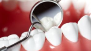 Víte, jak se starat o zubní implantát, aby vám dlouho vydržel? 
