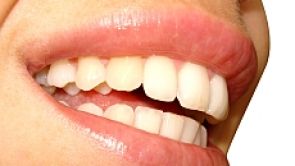 Kvalitní vs. "levné" zubní implantáty