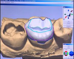 cerec-pc