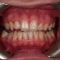 Dentální hygiena
